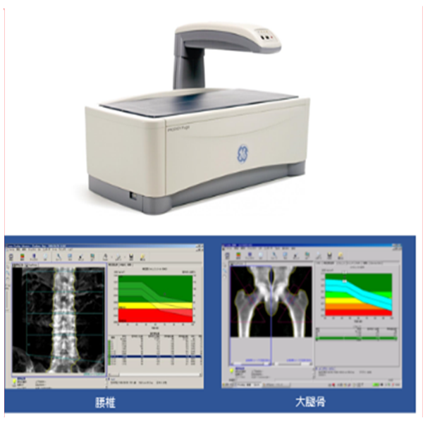 骨密度測定装置（DXA）